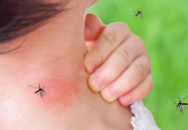 Tecniche del giardiniere per attrarre insetti utili e tenere lontane le zanzare dal tuo giardino